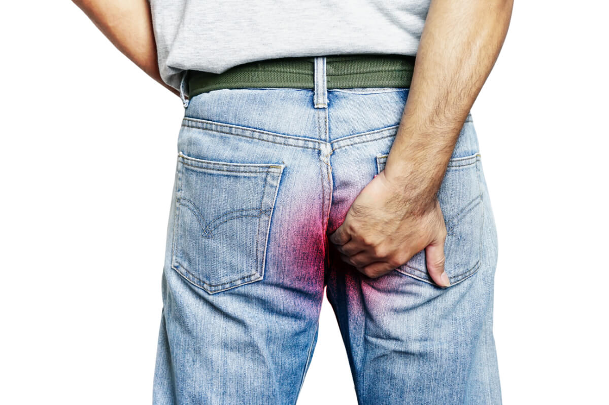 Hämorrhoiden – Ein gerne vermiedenes Thema